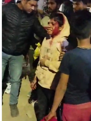 देहरादून में दिखे 3 बाघ, कैनाल रोड पर 12 साल के बच्चे पर किया हमला, घायल बच्चा दून अस्पताल में भर्ती